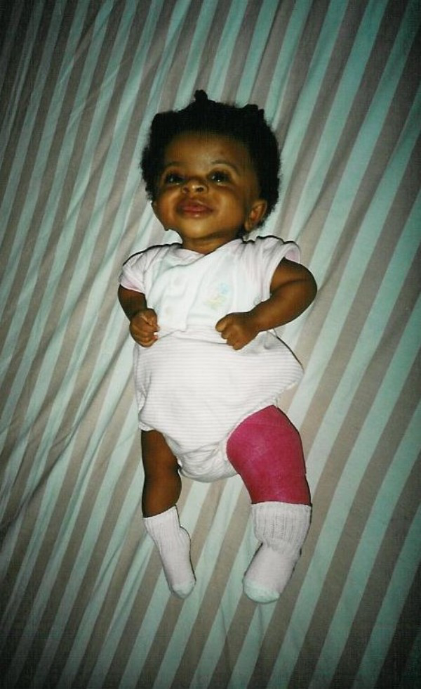 How One Girl S Strength Is Inspiring The World 15 Photos