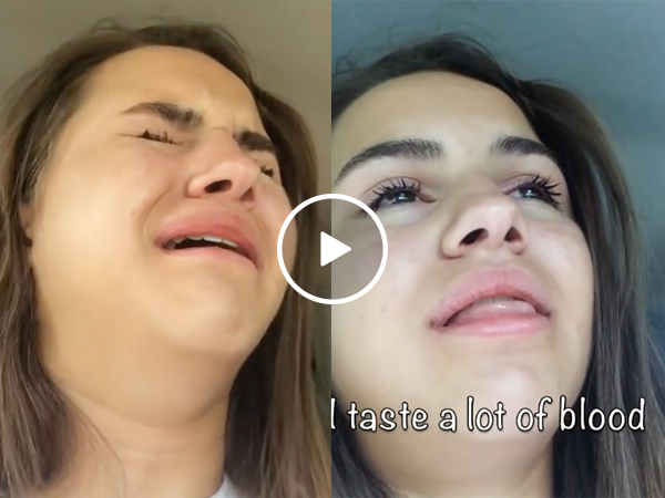 Girl high on anesthesia convinced she's become a vampire (Video)