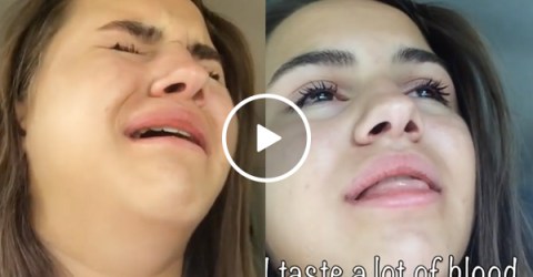 Girl high on anesthesia convinced she's become a vampire (Video)