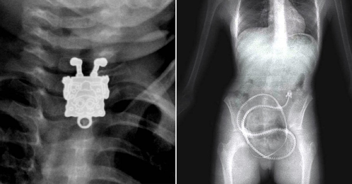 Some Weird And Wonderful X Rays 22 Photos