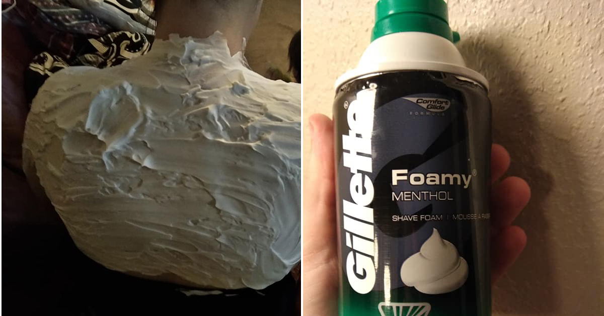 A Cure for Sunburns That Involves Gillette Shaving Cream
