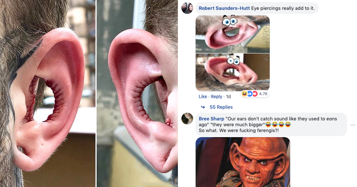 Guy removes inside of ears in bizarre body modification, gets ear