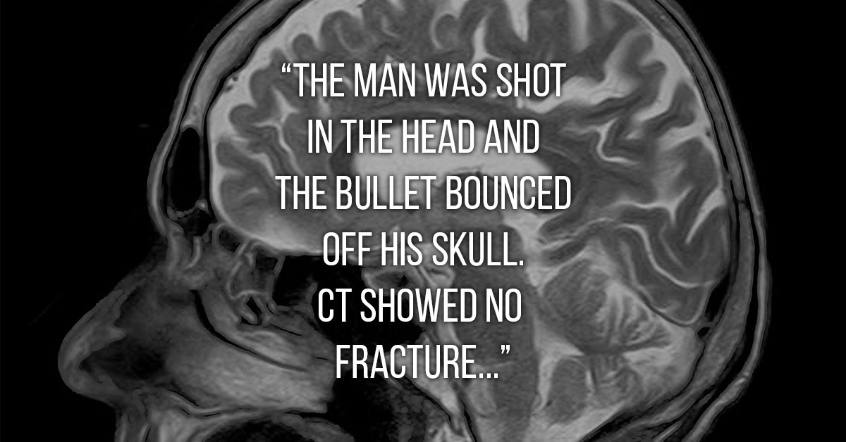 Doctors share their “How the f*** are they alive?” stories