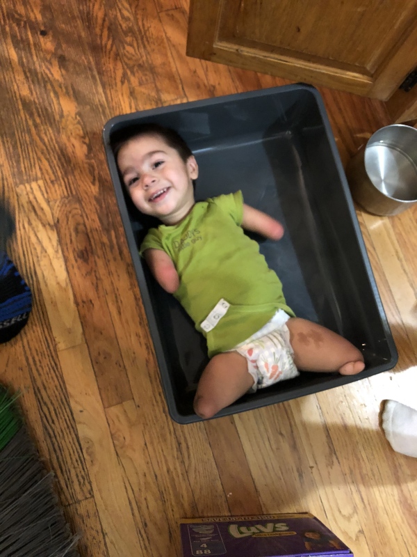 No arms, no legs, no problem. Meet Henry (12 Photos)