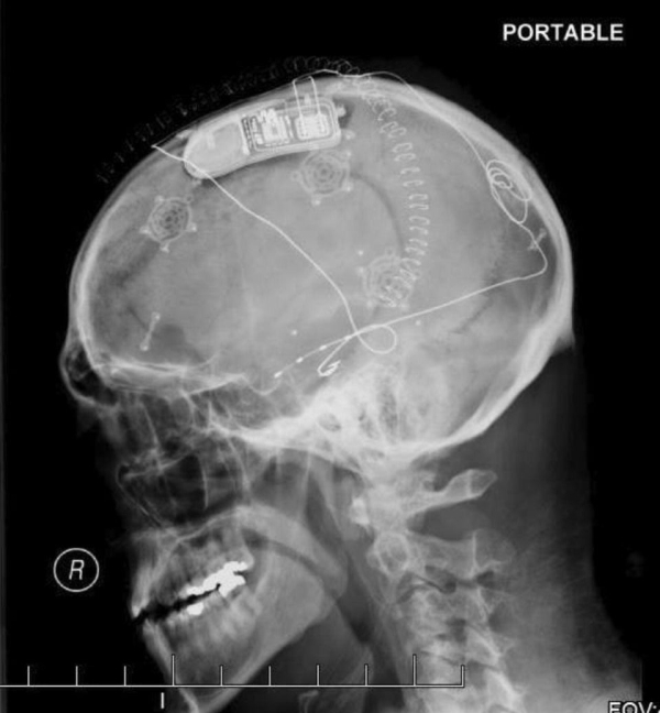 X-ray vision reveals incredible details that nature never could