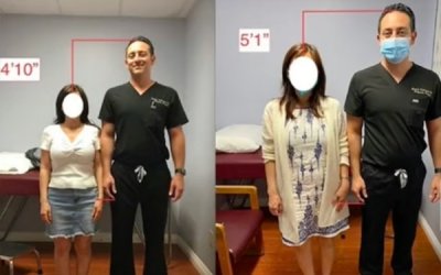 I spent $100K on leg-lengthening surgery to add 7 inches to my height