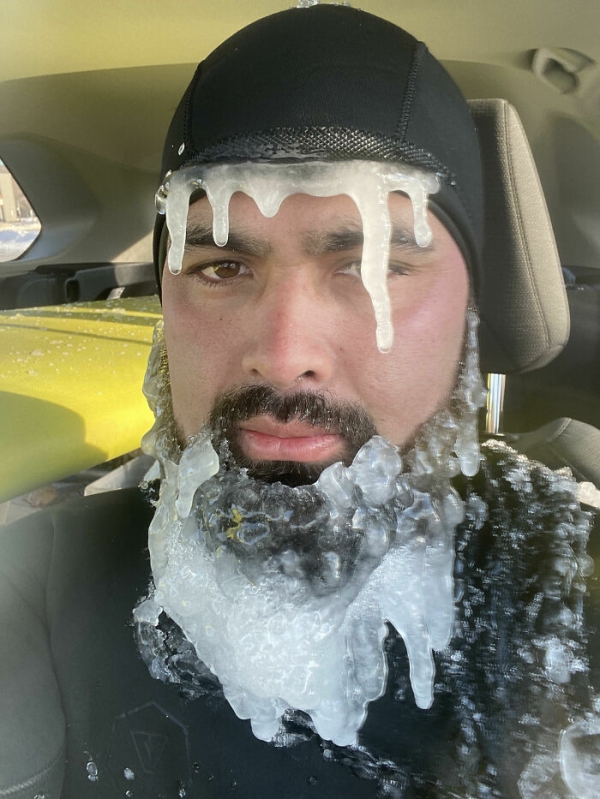 People show just how INSANELY cold it can get (32 Photos)