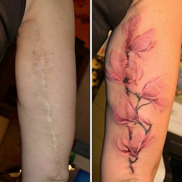 50 Inspiring Knee Tattoo Design Ideas For Women - Blurmark | Tattoos to  cover scars, Scars tattoo cover up, Knee tattoo