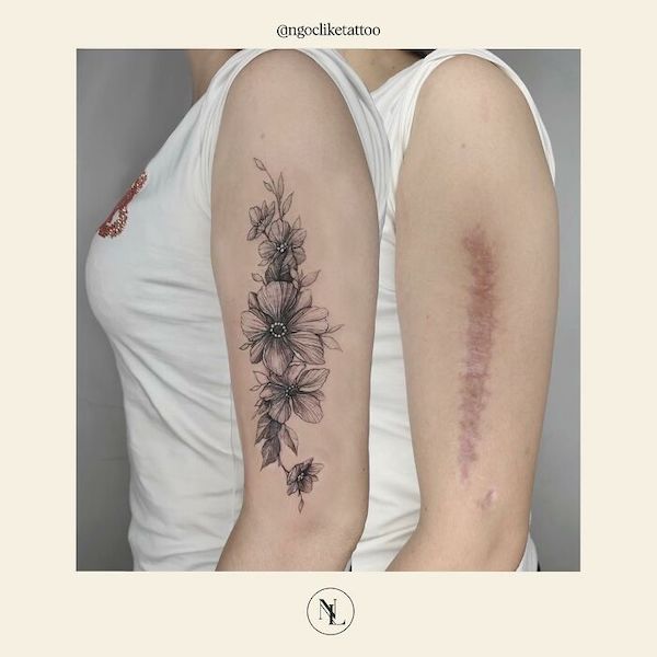 Can You Get a Tattoo Over a Burn Scar  AuthorityTattoo