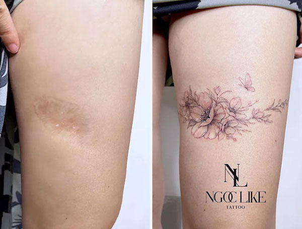 Scar coverup tattoo by Krzysztof Szeszko  Tattoogridnet