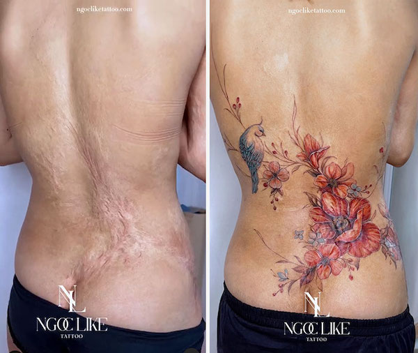 Scoliosis Scar Tattoo by emanscorfna  Tattoogridnet