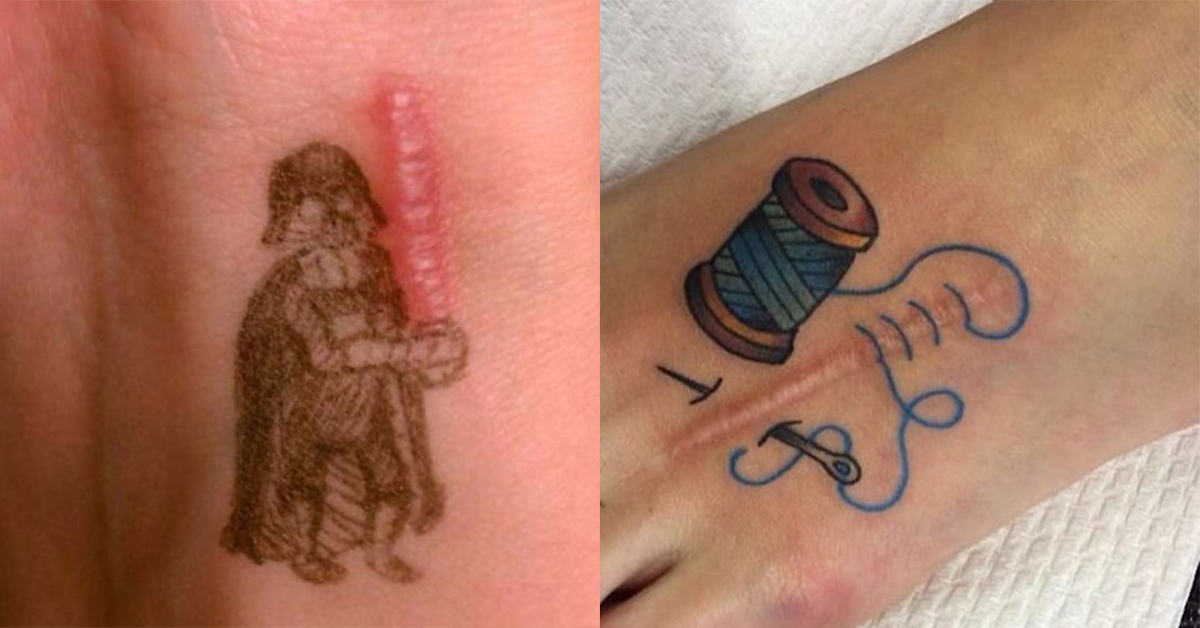 Scars transformed into clever works of art (25 photos)