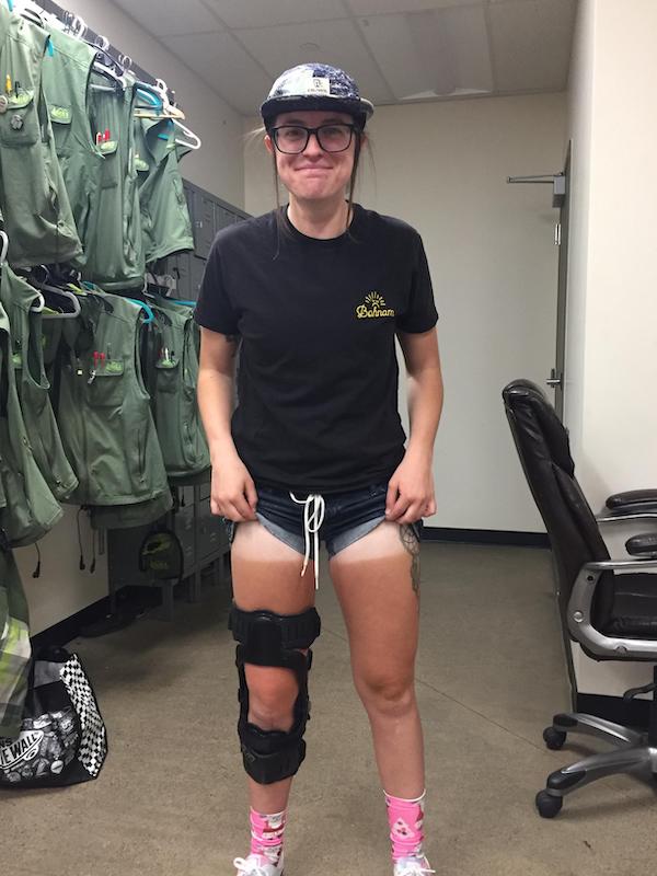 Do your best to avoid sunburn fails like these this Memorial Day