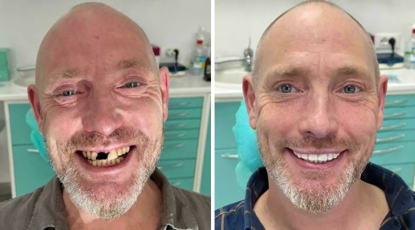 Comparison Pics That Might Blow Your Mind