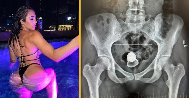 Aussie P*rnstar misplaces butt plug inside her body during first date Aussie P*rnstar misplaces butt plug inside her body during first date