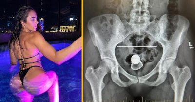 Aussie P*rnstar misplaces butt plug inside her body during first date Aussie P*rnstar misplaces butt plug inside her body during first date