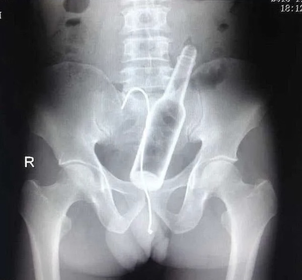 Strange and Bizarre X-Rays that fracture logic itself