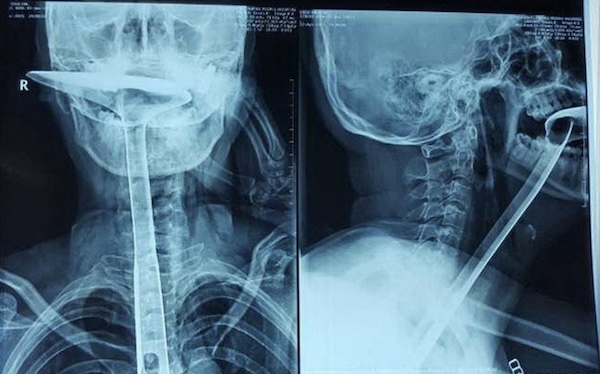 Strange and Bizarre X-Rays that fracture logic itself
