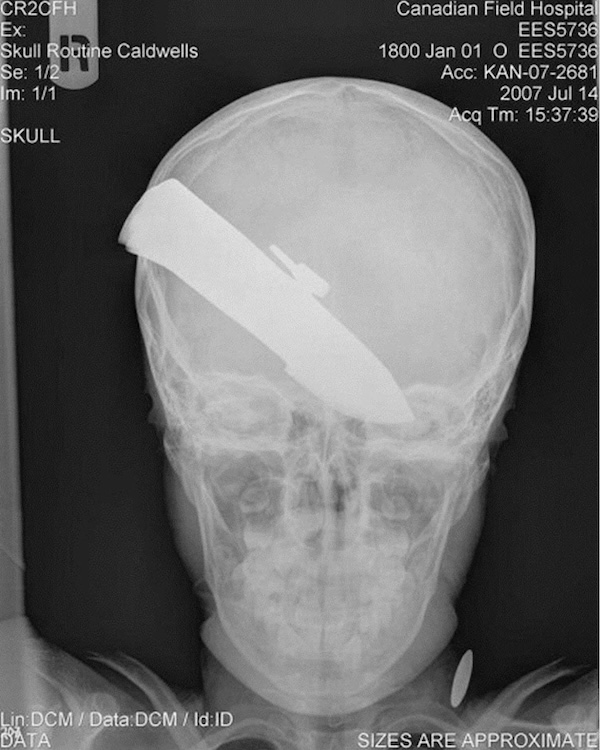 Strange and Bizarre X-Rays that fracture logic itself
