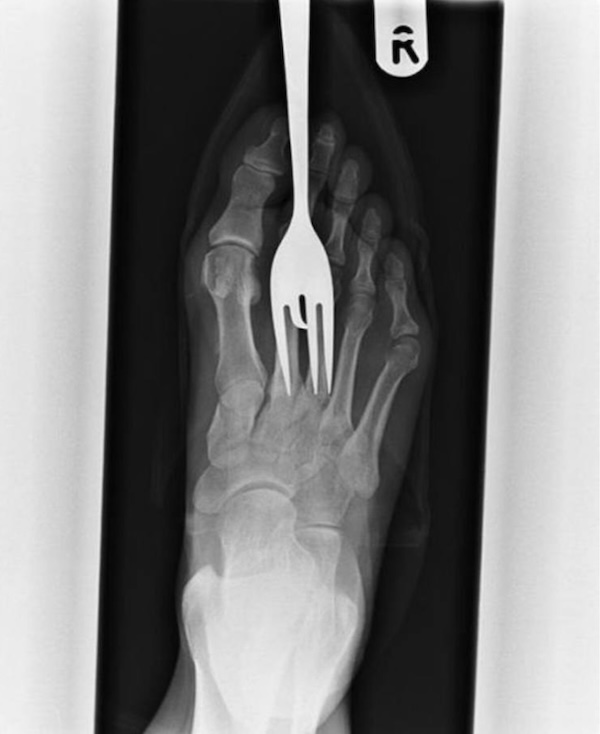 Strange and Bizarre X-Rays that fracture logic itself