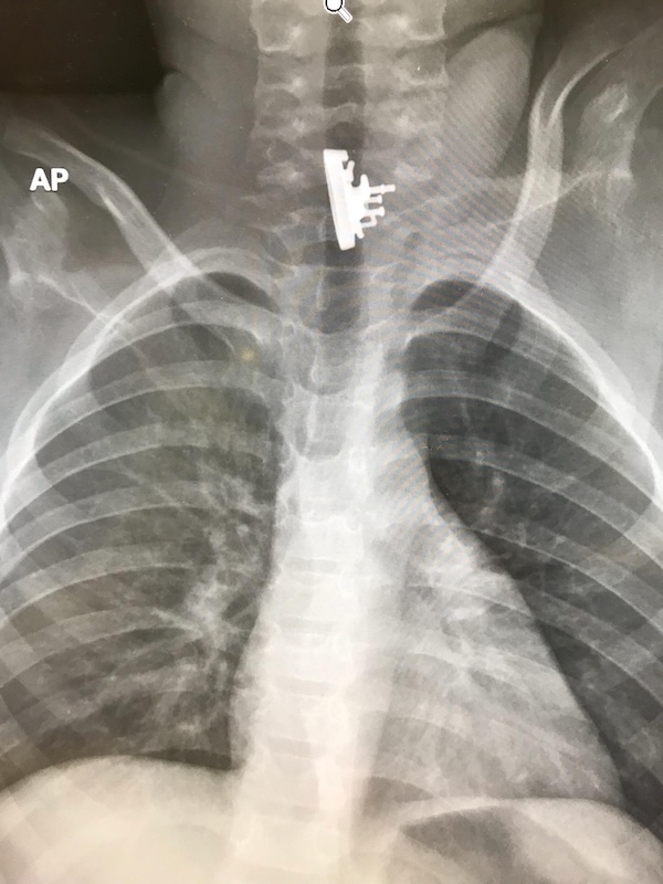 Strange and Bizarre X-Rays that fracture logic itself