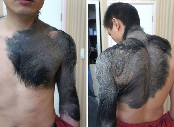 These Rare Mutations Are Simply Cool