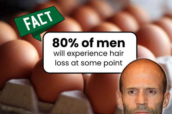 Bald Facts For All My Fellow Egg Heads Out There